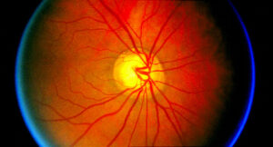 Retina